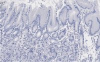 Anti-MYO1C Antibody, clone 4B19, ZooMAb Rabbit Monoclonal 
