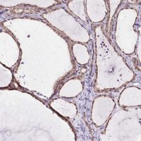 Anti-MYO5C antibody produced in rabbit 