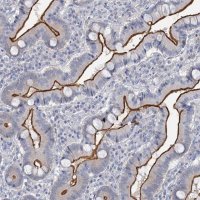 Anti-MYO7B antibody produced in rabbit 