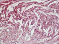 Anti-Myocardin antibody produced in rabbit SAB4200539-200UL