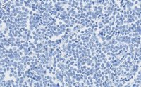 Anti-MyoD Antibody, clone 1F22 ZooMAb Rabbit Monoclonal 
