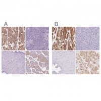 Anti-MYOM1 antibody produced in rabbit 