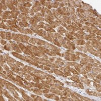 Anti-MYOM2 antibody produced in rabbit 