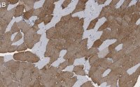 Anti-Myosin Heavy Chain 7 Antibody, clone 1B19, ZooMAb Rabbit Monoclonal 