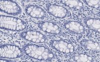 Anti-Na+-K+ ATPase 1 Antibody, clone 1E13 ZooMAb Rabbit Monoclonal 