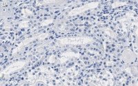 Anti-Na+/K+ ATPase -1 Antibody, clone C464.6 ZooMAb Mouse Monoclonal 