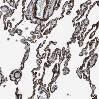 Anti-NAB1 antibody produced in rabbit 