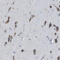 Anti-NACAD antibody produced in rabbit 