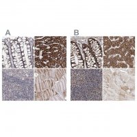 Anti-NADK2 antibody produced in rabbit 