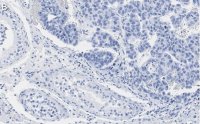 Anti-Nanog Antibody, clone 4C17 ZooMAb Rabbit Monoclonal 