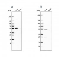 Anti-NAPRT antibody produced in rabbit 