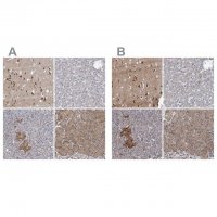 Anti-NBEA antibody produced in rabbit 