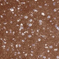 Anti-NCAM1 antibody produced in rabbit HPA039835-100UL
