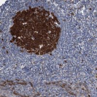 Anti-NCAPD2 antibody produced in rabbit 
