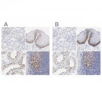 Anti-NCAPH antibody produced in rabbit 