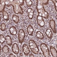 Anti-NCBP1 antibody produced in rabbit HPA049031-100UL