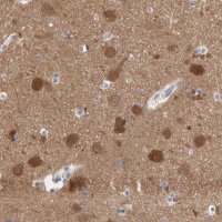 Anti-NCDN antibody produced in rabbit 