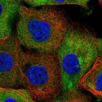 Anti-NCEH1 antibody produced in rabbit 
