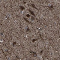 Anti-NCKAP1 antibody produced in rabbit 