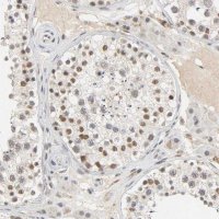 Anti-NCOA6 antibody produced in rabbit 