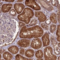 Anti-NDUFAF1 antibody produced in rabbit 
