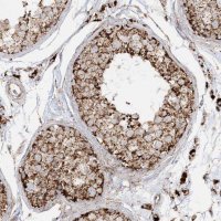 Anti-NDUFAF3 antibody produced in rabbit 