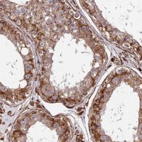 Anti-NDUFAF7 antibody produced in rabbit 