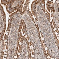 Anti-NDUFB11 antibody produced in rabbit 