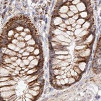 Anti-NDUFV3 antibody produced in rabbit 