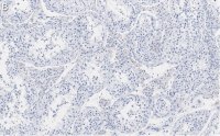 Anti-Nectin-2/CD112 Antibody, clone 2H6 ZooMAb Rabbit Monoclonal 