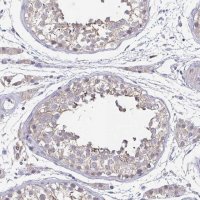 Anti-NEFH antibody produced in rabbit 