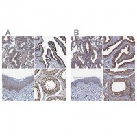 Anti-NEK1 antibody produced in rabbit 