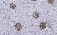Anti-Nestin Antibody, clone 8B8, ZooMAb Rabbit Monoclonal 