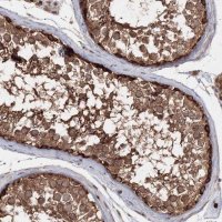 Anti-NEU4 antibody produced in rabbit 