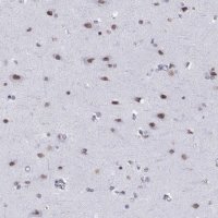 Anti-NEUROD6 