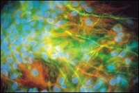 Anti-Neurofilament 200 antibody produced in rabbit 