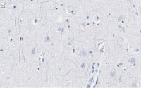 Anti-Neurofilament H Antibody, clone 2N19 ZooMAb Rabbit Monoclonal 