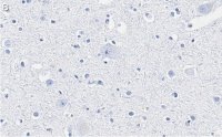 Anti-Neurofilament L Antibody, clone 1E13 ZooMAb Rabbit Monoclonal 