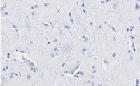 Anti-Neurofilament M Antibody, clone 1B23 ZooMAb Rabbit Monoclonal 
