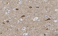 Anti-Neurogranin Antibody, clone 1D4 , ZooMAb Rabbit Monoclonal 