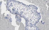 Anti-NF-kB p65 subunit Antibody, clone 1D8 ZooMAb Rabbit Monoclonal 