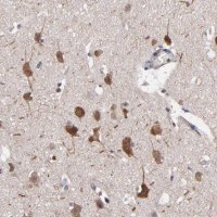 Anti-NF2 antibody produced in rabbit 