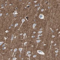 Anti-NFASC antibody produced in rabbit 