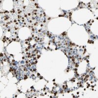 Anti-NFKBIZ antibody produced in rabbit 