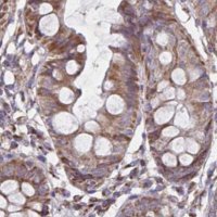 Anti-NFS1 antibody produced in rabbit 