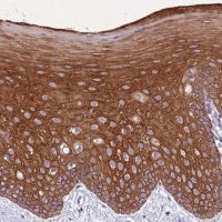 Anti-NLRP11 antibody produced in rabbit 