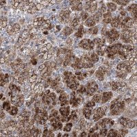 Anti-NME7 antibody produced in rabbit 