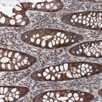 Anti-NMRAL1 antibody produced in rabbit HPA041353-100UL
