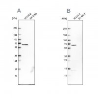 Anti-NMT1 antibody produced in rabbit 