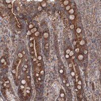 Anti-NOA1 antibody produced in rabbit 